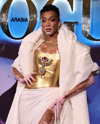 شاهد .. بالصور- ميريام فارس تتالق بفستان رائع و إرتدته قبلها هذه النجمة العالمية