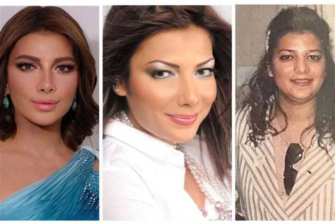 أصالة قبل وبعد عمليات التجميل.. شكلها أحلي وسنها أصغر