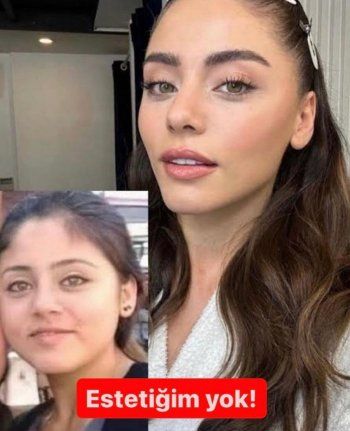 شاهد .. بطلة "شراب التوت" هل أجرت عمليات تجميل؟ وصورة مسرّبة لها من طفولتها