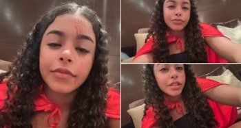 شاهد .. هكذا احتفلت إبنة شيرين عبد الوهاب بـ هالويين .. وما قصة الخدوش على وجهها؟