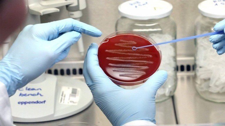 اكتشاف حلول جديدة لمكافحة البكتيريا المقاومة للمضادات الحيوية