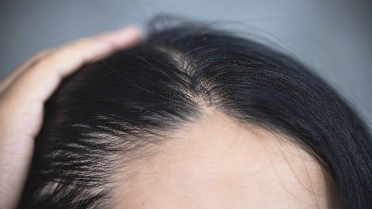 الجينسنغ.. الحل الطبيعي لتعزيز نمو الشعر ومنع تساقطه