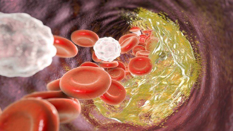 اكتشاف جديد يعيد النظر في دور الكوليسترول "الجيد" في صحة القلب