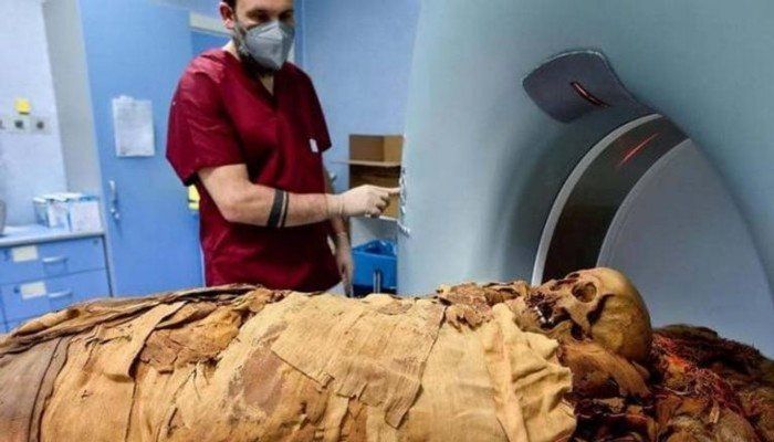 اكتشاف علمي يكشف أسرار الطاعون في مصر القديمة.. أول دليل جيني على «الموت الأسود» في شمال أفريقيا