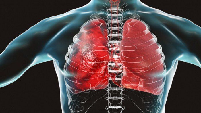 دراسة حديثة: الفيروس التاجي يؤثر على الكلى أكثر من الرئتين