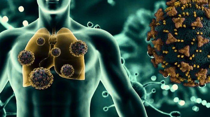 الهند تسجل إصابتين بفيروس الالتهاب الرئوي البشري (HMPV).. هل يتحول إلى وباء عالمي؟