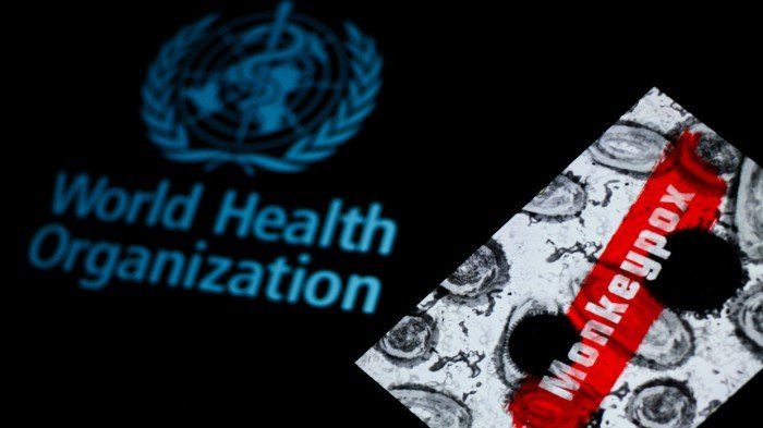 الصحة العالمية تعلن تسجيل 14700 حالة إصابة مؤكدة بجدري القردة في إفريقيا