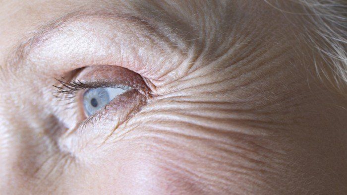 أخطاء شائعة تسرع ظهور التجاعيد العميقة ونصائح للوقاية منها