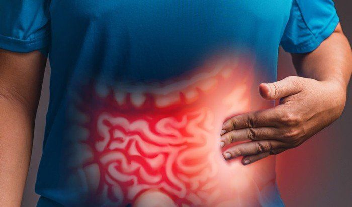 تقنية مبتكرة للتنبؤ بسرطان الأمعاء بدقة تفوق 90%