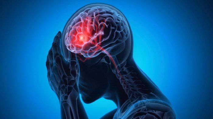 عادة يومية بسيطة قد تقلل من خطر الإصابة بالسكتة الدماغية