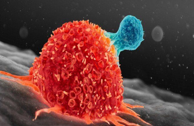 اكتشاف طبي مهم قد يمنع انتشار السرطان قبل تفشيه في الجسم