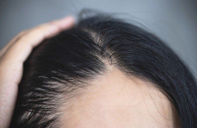 طبيبة تكشف عن مكون طبيعي يعالج مشكلات فروة الرأس