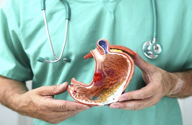 تحذير طبي.. أمراض الجهاز الهضمي قد تزيد خطر الإصابة بالسرطان