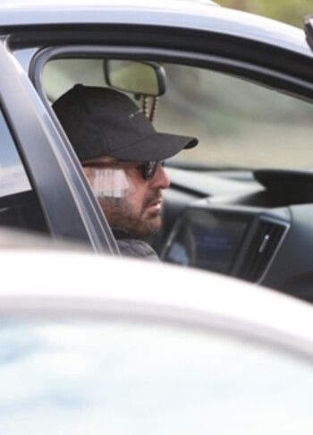 شاهد .. كدمات على وجه أحمد السقا في أول ظور له بعد تعرضه لإصابة