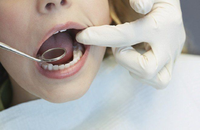 دراسة تكشف ارتباطًا جينيًا يزيد خطر تسوس الأسنان وأمراض اللثة