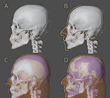 شاهد .. الكشف عن وجه موزارت الحقيقي لأول مرة منذ 230 عاماً