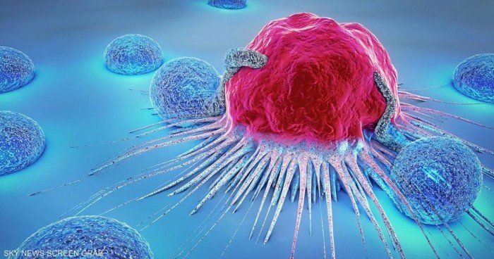 علماء روس يطورون أول دواء مزدوج لعلاج أخطر أنواع السرطان