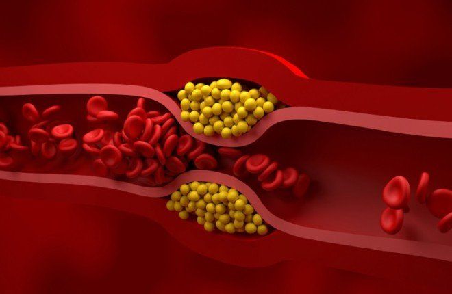 ما هي الاستراتيجية الأكثر كفاءة لخفض الكوليسترول الضار وتقليل مخاطر أمراض القلب؟