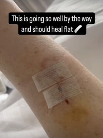 شاهد .. تطورات الحالة الصحية لـ كاثرين رايان بعد إصابتها بهذا المرض