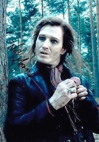 شاهد .. أزمة صحية تهدد حياة نجم Harry Potter