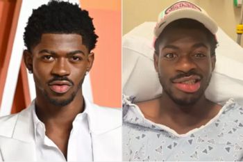 شاهد .. ليل ناس إكس يعلن إصابته بشلل جزئي في وجهه ويظهر من المستشفى - بالصورة