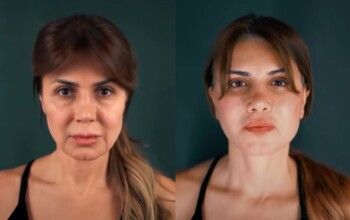 شاهد .. نجلاء بدر تخضع لعملية تجميلية وتستعيد ملامحها في عمر الشباب