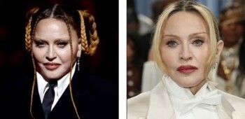 شاهد .. جراحو التجميل يكشفون عن المشاهير الذين خضعوا لعمليات تجميل في حفل Met Gala