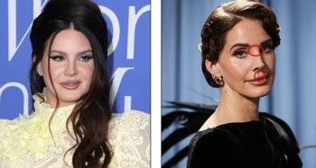 شاهد .. جراحو التجميل يكشفون عن المشاهير الذين خضعوا لعمليات تجميل في حفل Met Gala