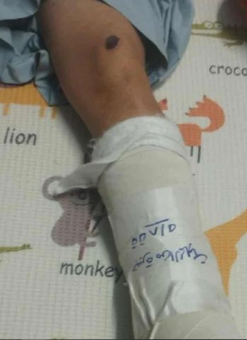 شاهد .. ممثل مصري شهير متهم في إصابة موظف بحادث سير والتحقيقات جارية