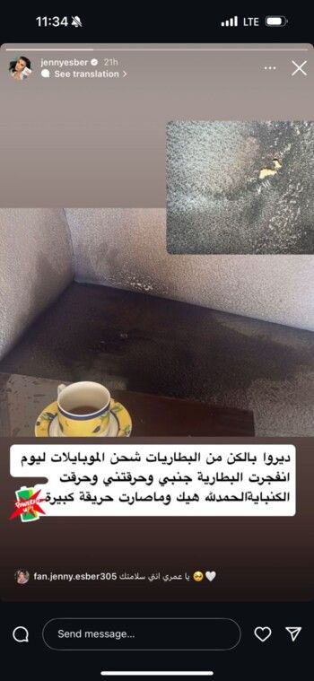 شاهد .. جيني إسبر تنجو من حريق خطير بسبب هاتفها.. هذا ما حصل معها!