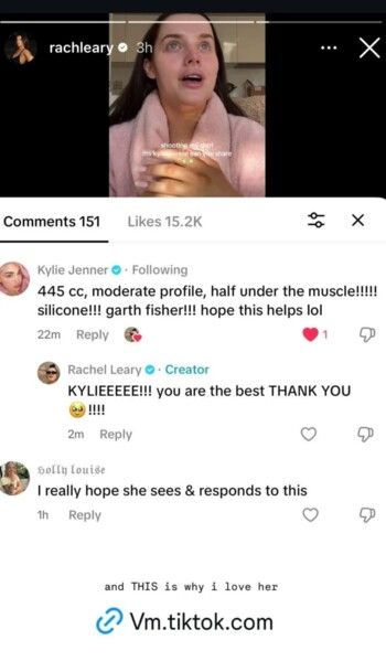 شاهد .. في تصريح جريء.. كايلي جينر تعترف بخضوعها لعملية تكبير للصدر