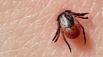 شاهد .. لدغة قرادة تنقل ممثلة تركية شهيرة إلى المستشفى