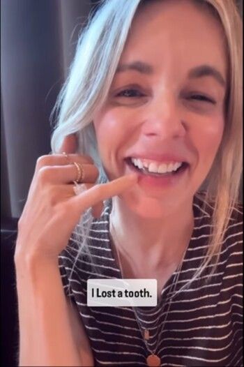 شاهد .. لحظة محرجة للغاية .. سقوط "سنّ" نجمة برنامج الواقع أثناء العشاء مع أصدقائها