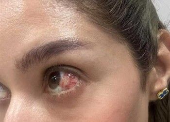 شاهد .. خطأ طبي وتدهور في الحالة الصحية لفنانة شهيرة