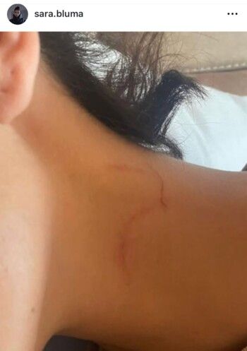 شاهد .. آثار الضرب على وجهها.. حبيبة جان يامان الجزائرية تكسر صمتها وتتحدث عن معاناتها