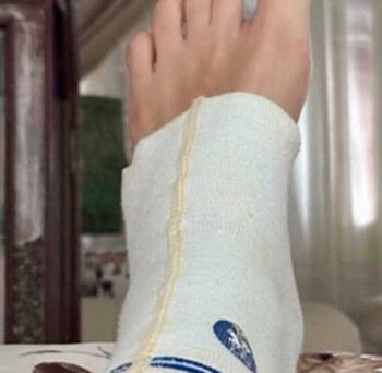 شاهد .. ممثلة شهيرة تتعرض لإصابة.. وتثير قلق محبيها