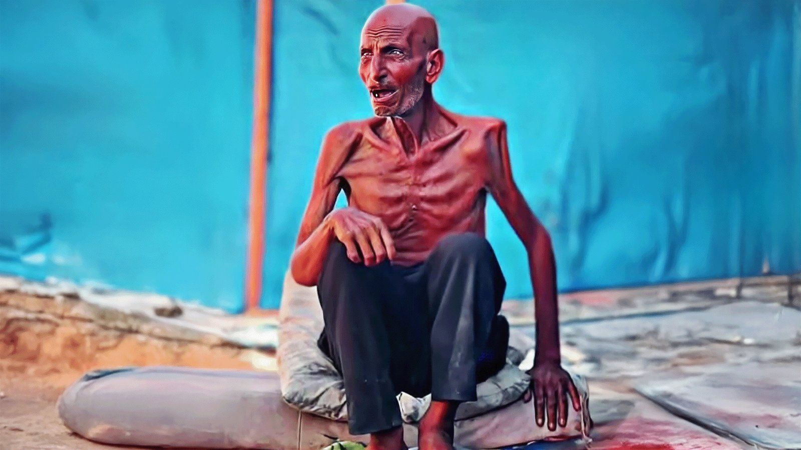 اتفرج – صور المجاعة بغزة مستمرة ومغردون: قلوبنا مفطورة