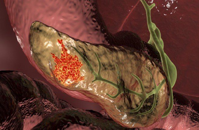 اكتشاف جزيء سكري قد يفتح آفاقاً جديدة لعلاج سرطان البنكرياس