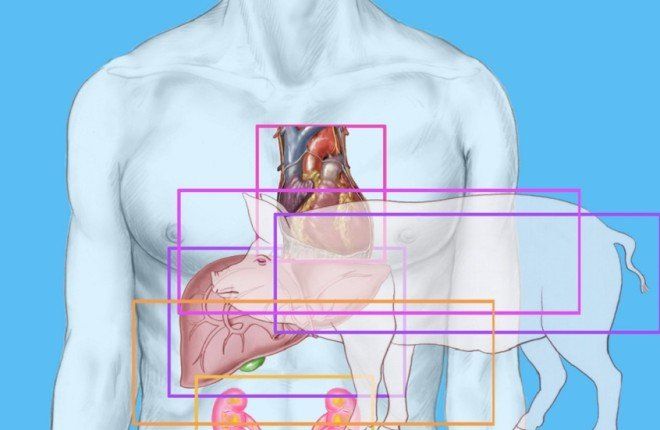 الصين تسجل سابقة طبية عالمية بزراعة كبد خنزير معدل وراثيا لمريض حي