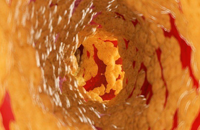 دراسة حديثة: دهون خفية حول الأعضاء تهدد الشرايين حتى لدى النحفاء