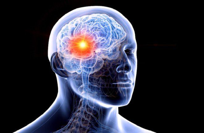 أعراض يومية شائعة قد تنذر مبكرًا بأورام في الدماغ.. تعرف عليها