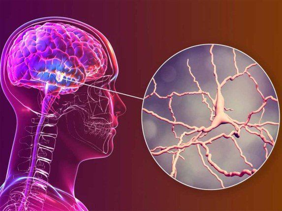 علماء يطورون نظام ذكاء اصطناعي يشخص نوعا من ورم الدماغ