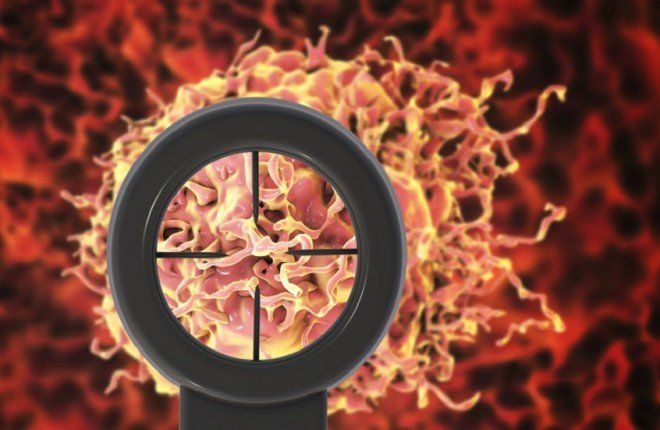 اكتشاف علمي ثوري.. أدوية الصداع النصفي تفتح باباً جديداً لعلاج السرطان