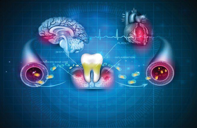 صحة فمك مرآة لقلبك ودماغك.. دراستان تكشفان علاقة خطيرة بين أمراض اللثة وتلف الدماغ
