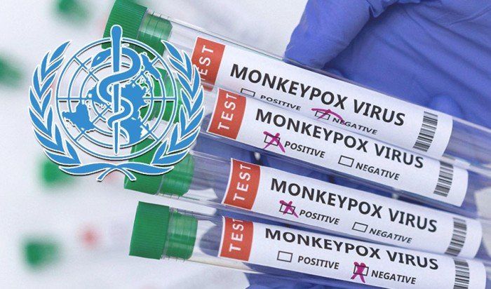«الصحة العالمية»: تسجيل إصابات جديدة بجدري القردة وظهور السلالة «آي.بي» في دول جديدة
