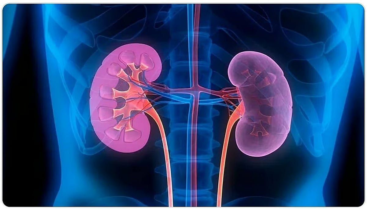 اتفرج – مستشفى أجياد الطوارئ يوضح طرق الوقاية من حصى الكلى