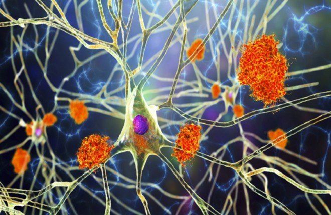 "النبات المعجزة".. اكتشاف مركبات واعدة في الصبّار قد تمهّد لعلاج ألزهايمر