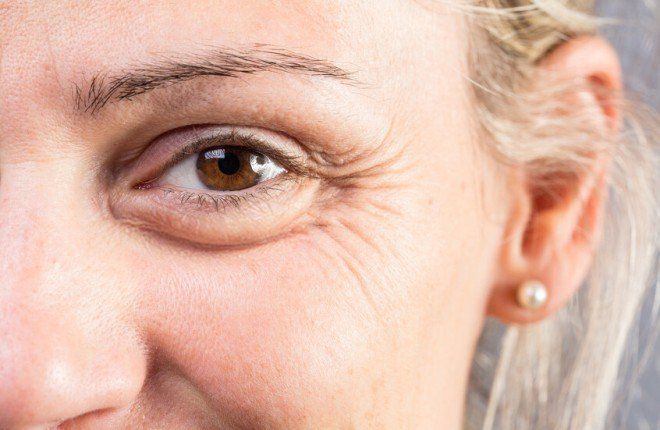 تجاعيد حول العين قد تنذر بتراجع صحة الدماغ وخطر الخرف