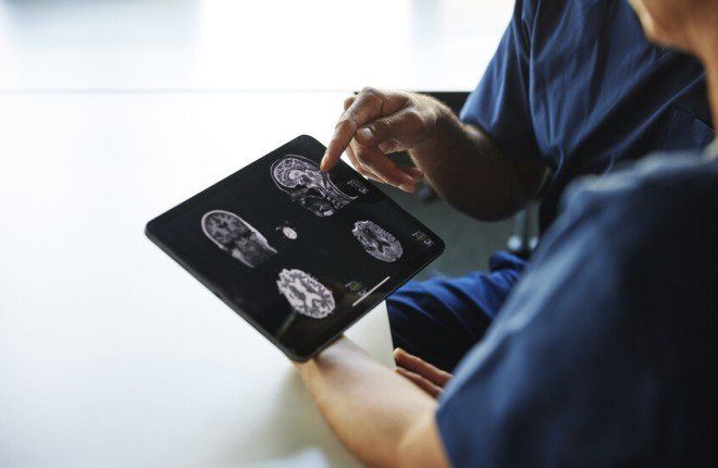 دراسة تكشف علاقة مفاجئة بين حجم الرأس وزيادة خطر الإصابة بالخرف