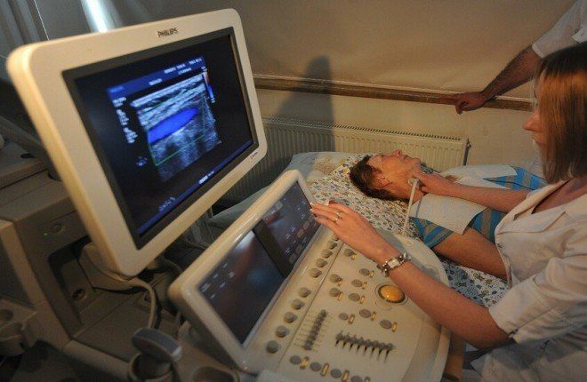 إنذارات صحية تستدعي فحص شرايين الرقبة بالموجات فوق الصوتية.. تعرف عليها